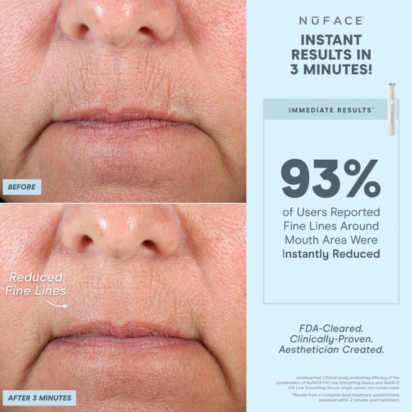 NWT! NuFACE FIX Line Smoothing Device - Picture 11 of 12